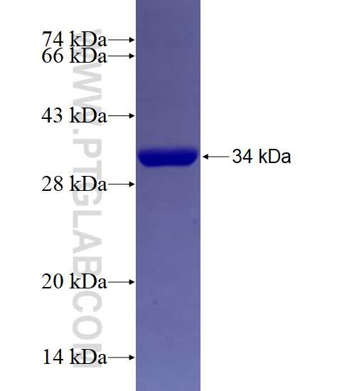 GNMT fusion protein Ag4598 SDS-PAGE