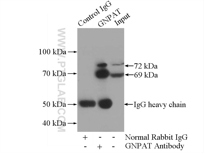 Immunoprecipitation (IP) experiment of COLO 320 cells using GNPAT Polyclonal antibody (14931-1-AP)