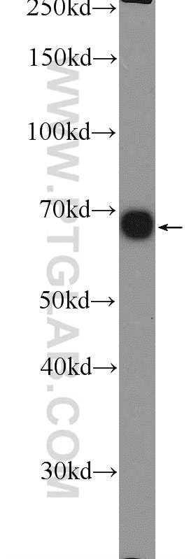 Western Blot (WB) analysis of HepG2 cells using GNPAT Polyclonal antibody (14931-1-AP)