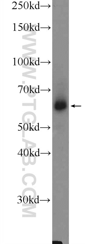 Western Blot (WB) analysis of human placenta tissue using GNPAT Polyclonal antibody (14931-1-AP)