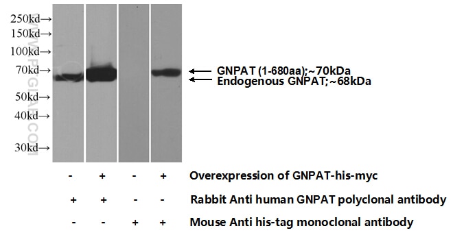 Western Blot (WB) analysis of Transfected HEK-293 cells using GNPAT Polyclonal antibody (14931-1-AP)