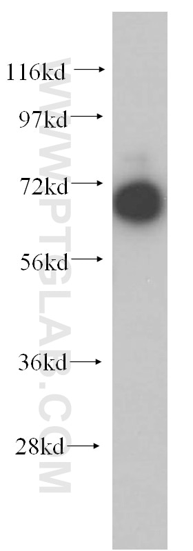 Western Blot (WB) analysis of PC-3 cells using GNPAT Polyclonal antibody (14931-1-AP)