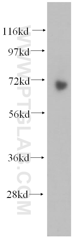 Western Blot (WB) analysis of mouse brain tissue using GNPAT Polyclonal antibody (14931-1-AP)