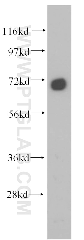Western Blot (WB) analysis of HeLa cells using GNPAT Polyclonal antibody (14931-1-AP)