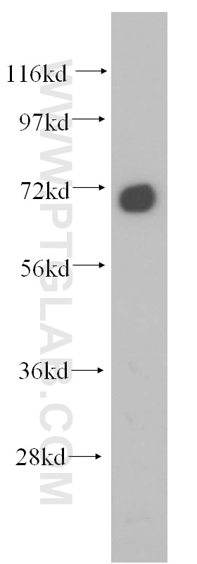 WB analysis of HeLa using 14931-1-AP