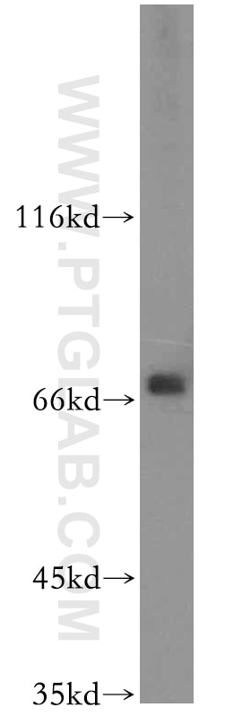 Western Blot (WB) analysis of COLO 320 cells using GNPAT Polyclonal antibody (14931-1-AP)