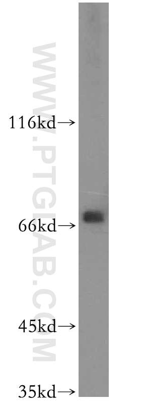 WB analysis of COLO 320 using 14931-1-AP