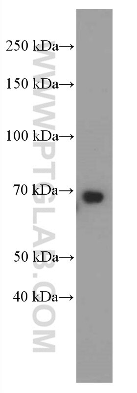 Western Blot (WB) analysis of HeLa cells using GNPAT Monoclonal antibody (66453-1-Ig)