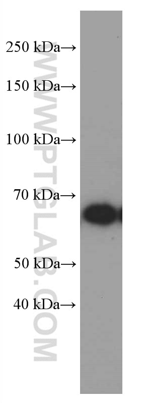 Western Blot (WB) analysis of COLO 320 cells using GNPAT Monoclonal antibody (66453-1-Ig)