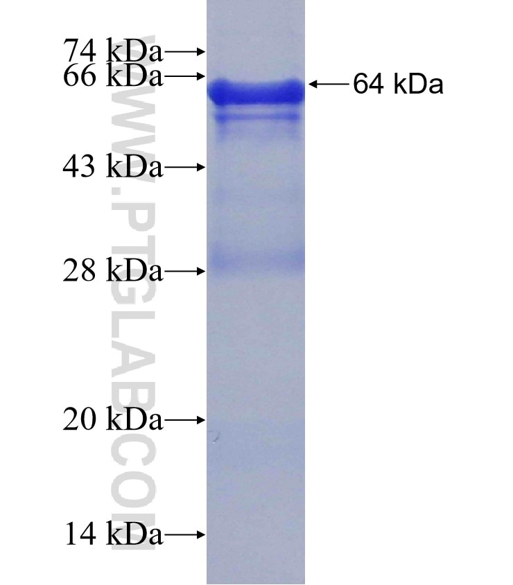 GNPAT fusion protein Ag6735 SDS-PAGE