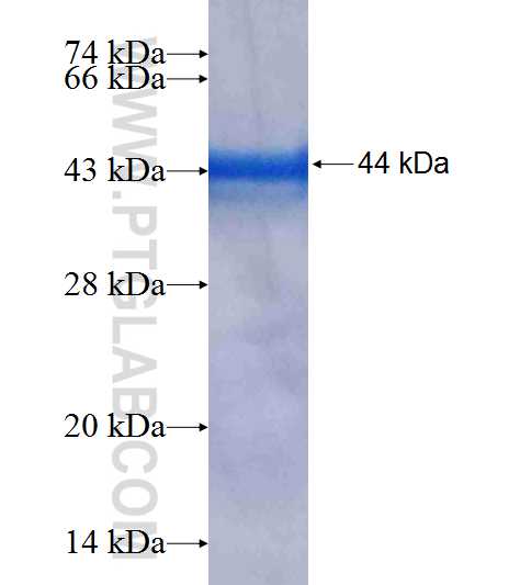 GNPAT fusion protein Ag6740 SDS-PAGE