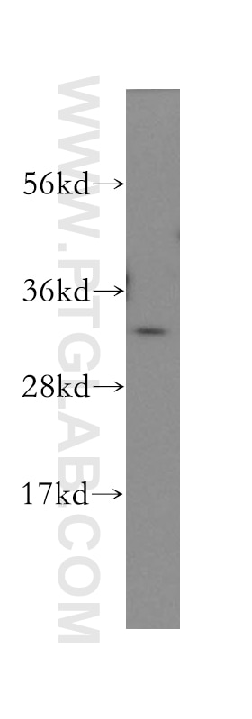 Western Blot (WB) analysis of human brain tissue using GNPDA1 Polyclonal antibody (12312-1-AP)