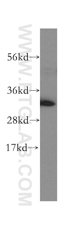 Western Blot (WB) analysis of HeLa cells using GNPDA1 Polyclonal antibody (12312-1-AP)
