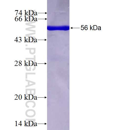 GNPDA1 fusion protein Ag2961 SDS-PAGE