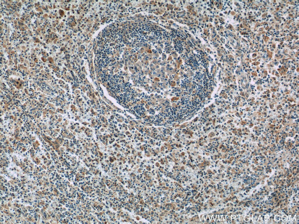 Immunohistochemistry (IHC) staining of human spleen tissue using GNPDA2 Polyclonal antibody (17105-1-AP)