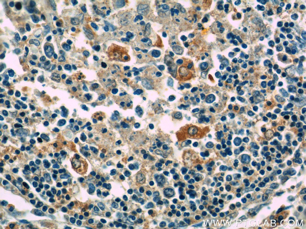 Immunohistochemistry (IHC) staining of human spleen tissue using GNPDA2 Polyclonal antibody (17105-1-AP)