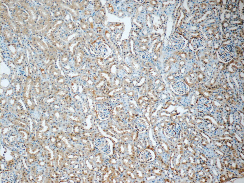 Immunohistochemistry (IHC) staining of mouse kidney tissue using GNPDA2 Polyclonal antibody (17105-1-AP)