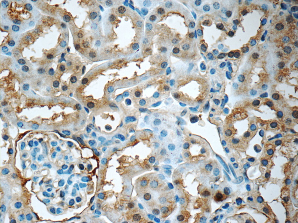 Immunohistochemistry (IHC) staining of mouse kidney tissue using GNPDA2 Polyclonal antibody (17105-1-AP)