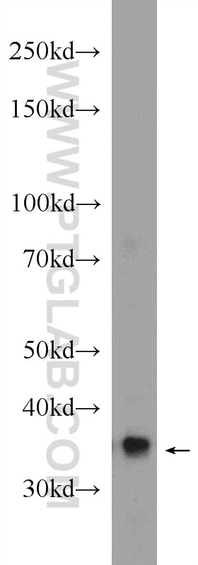 Western Blot (WB) analysis of mouse kidney tissue using GNPDA2 Polyclonal antibody (17105-1-AP)