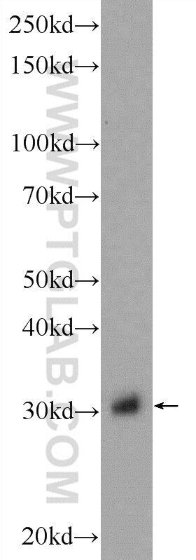 Western Blot (WB) analysis of rat kidney tissue using GNPDA2 Polyclonal antibody (17105-1-AP)