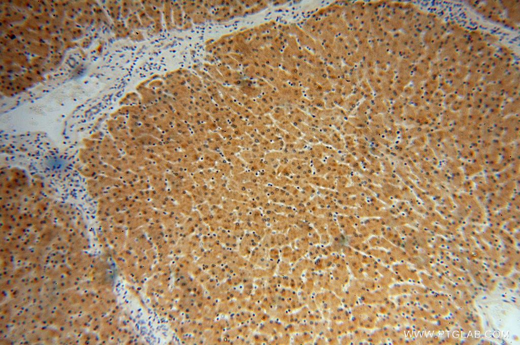 Immunohistochemistry (IHC) staining of human liver tissue using GNPNAT1 Polyclonal antibody (16282-1-AP)