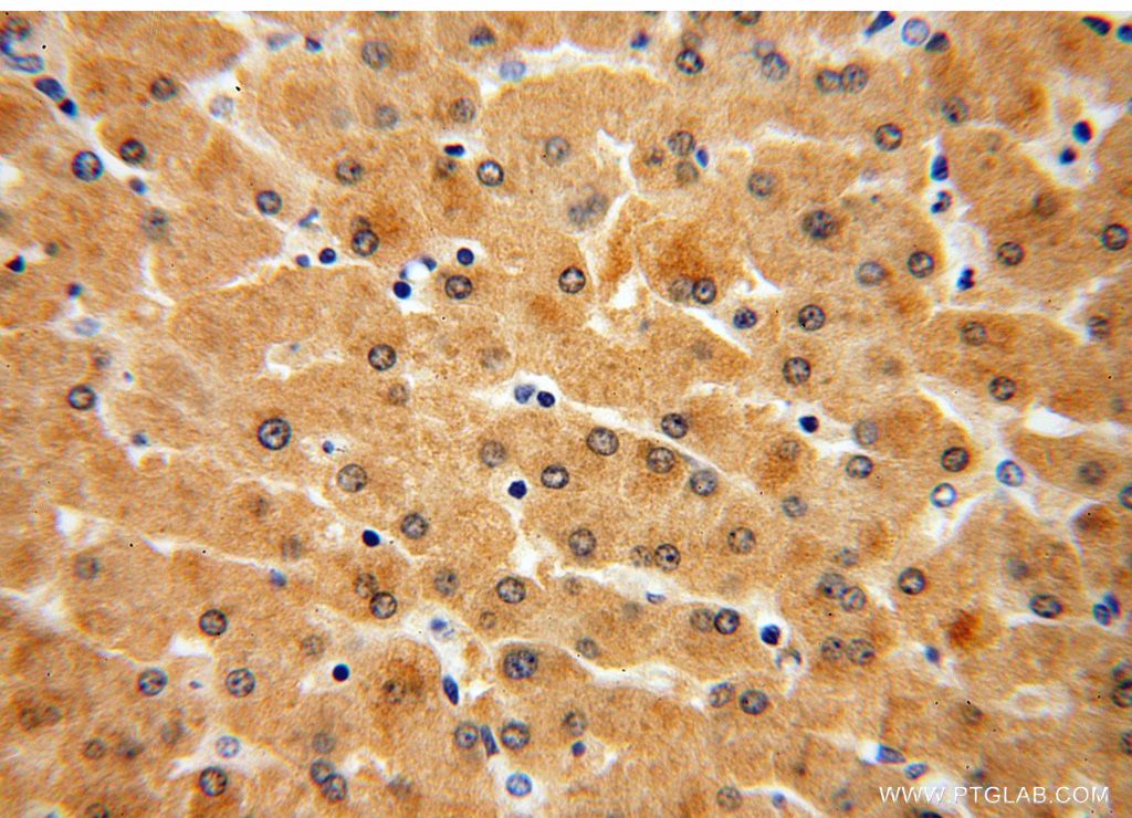 Immunohistochemistry (IHC) staining of human liver tissue using GNPNAT1 Polyclonal antibody (16282-1-AP)