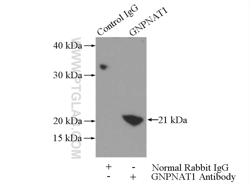 Immunoprecipitation (IP) experiment of mouse large intestine tissue using GNPNAT1 Polyclonal antibody (16282-1-AP)