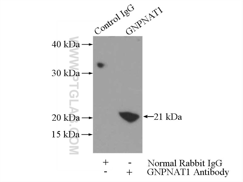 IP experiment of mouse large intestine using 16282-1-AP