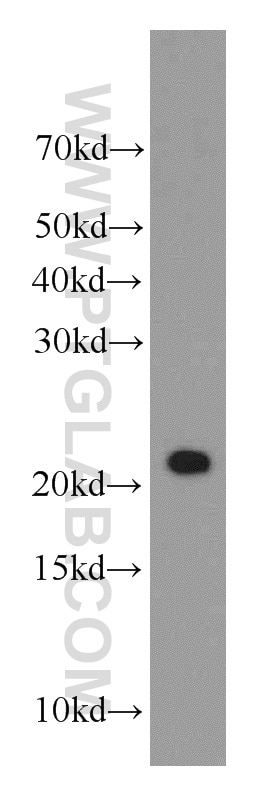 WB analysis of mouse large intestine using 16282-1-AP