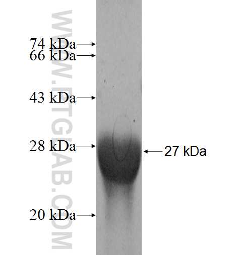 GNPNAT1 fusion protein Ag9375 SDS-PAGE