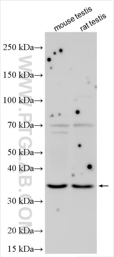 Western Blot (WB) analysis of various lysates using GNPTG Polyclonal antibody (14074-1-AP)