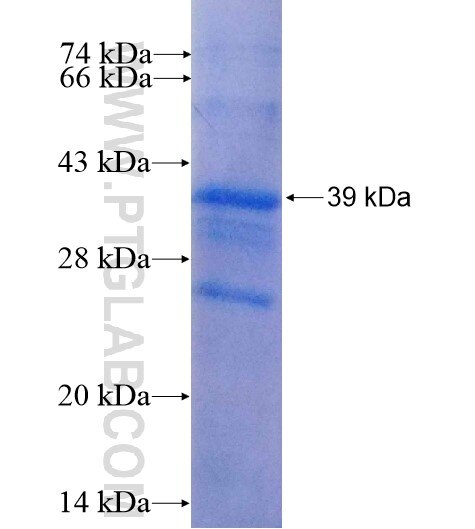 GNPTG fusion protein Ag5153 SDS-PAGE