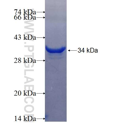 GNRH1 fusion protein Ag25667 SDS-PAGE