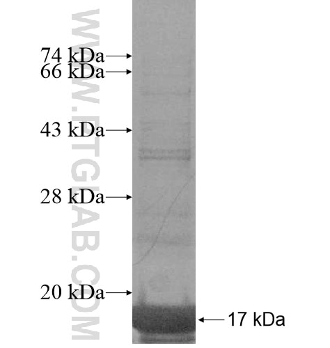 GNRH2 fusion protein Ag15498 SDS-PAGE
