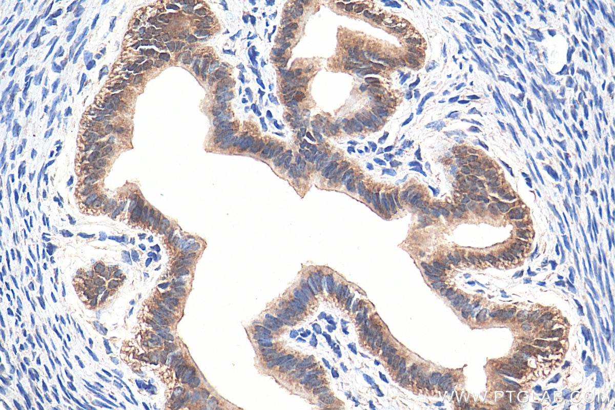 Immunohistochemistry (IHC) staining of mouse ovary tissue using GNRHR Polyclonal antibody (19950-1-AP)