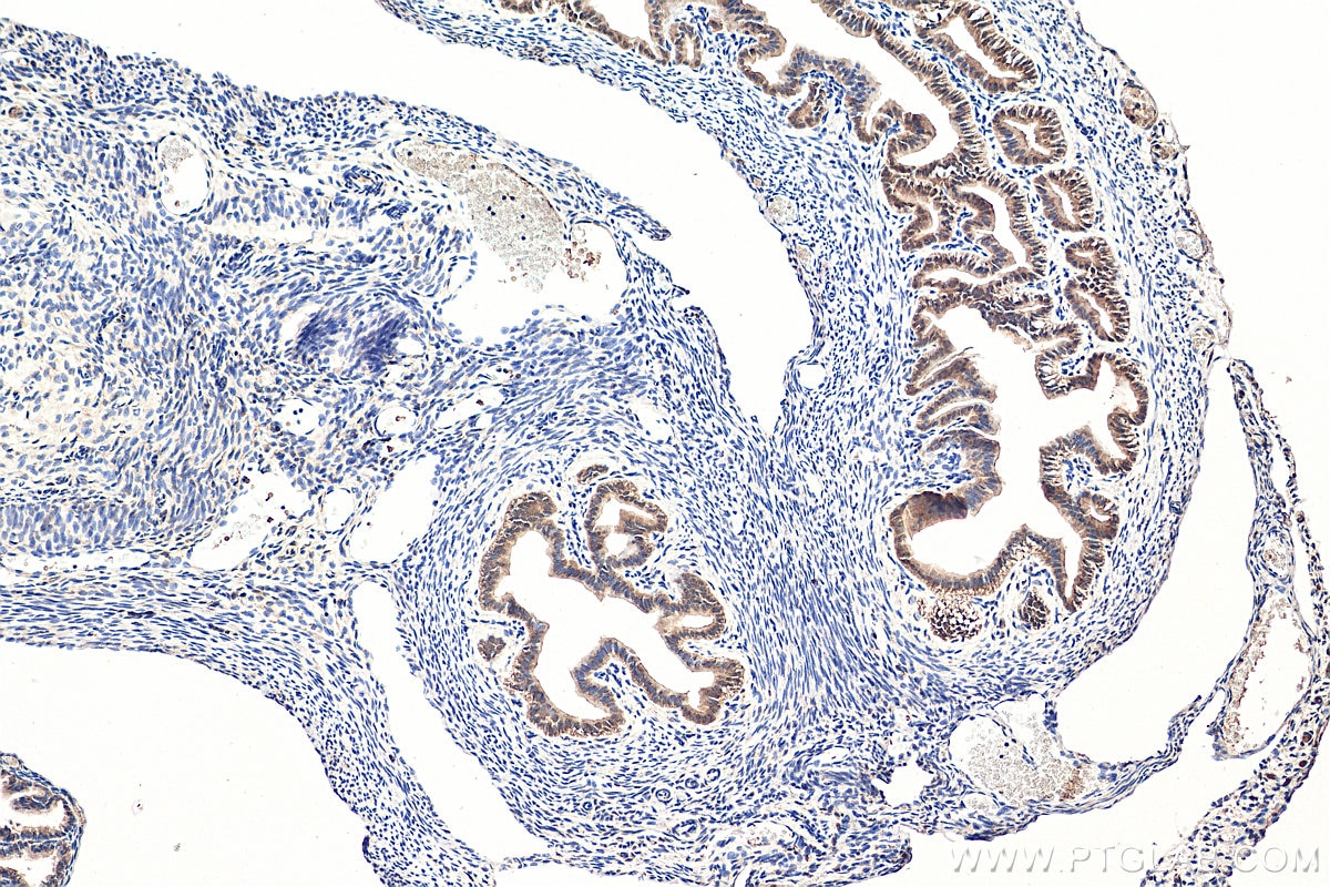 IHC staining of mouse ovary using 19950-1-AP
