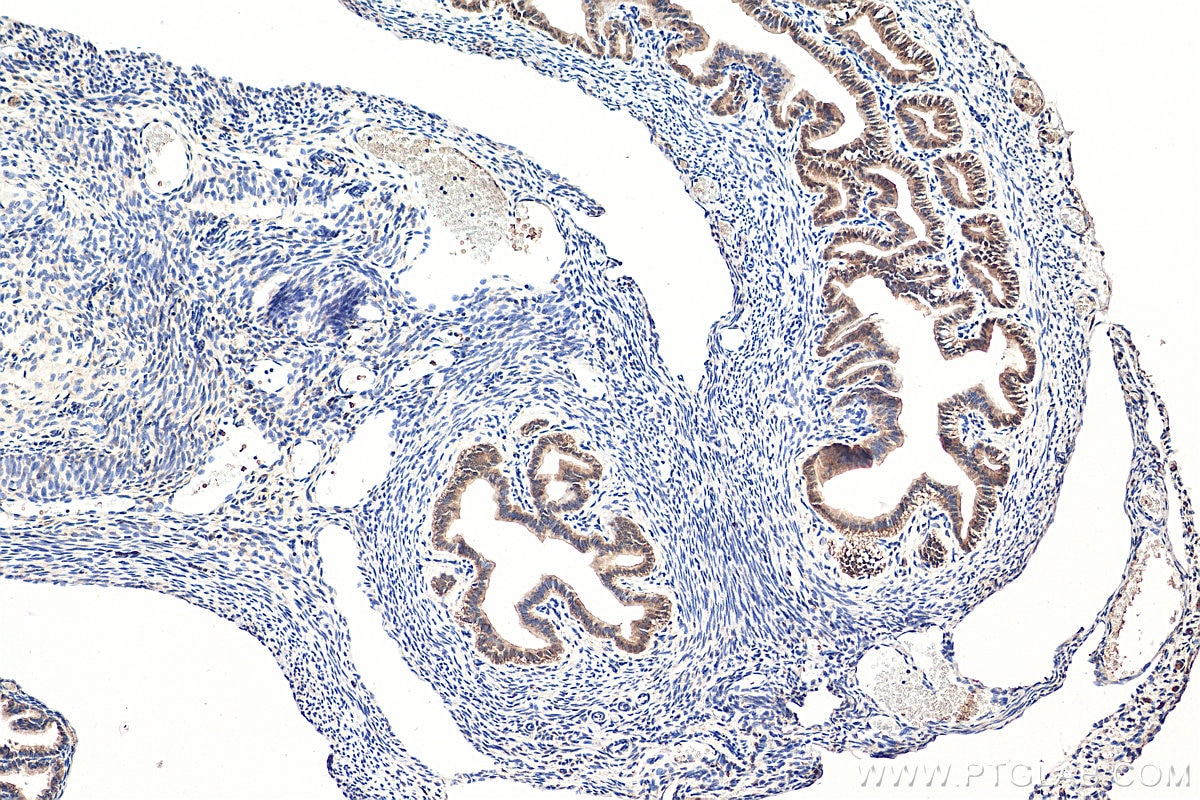 Immunohistochemistry (IHC) staining of mouse ovary tissue using GNRHR Polyclonal antibody (19950-1-AP)