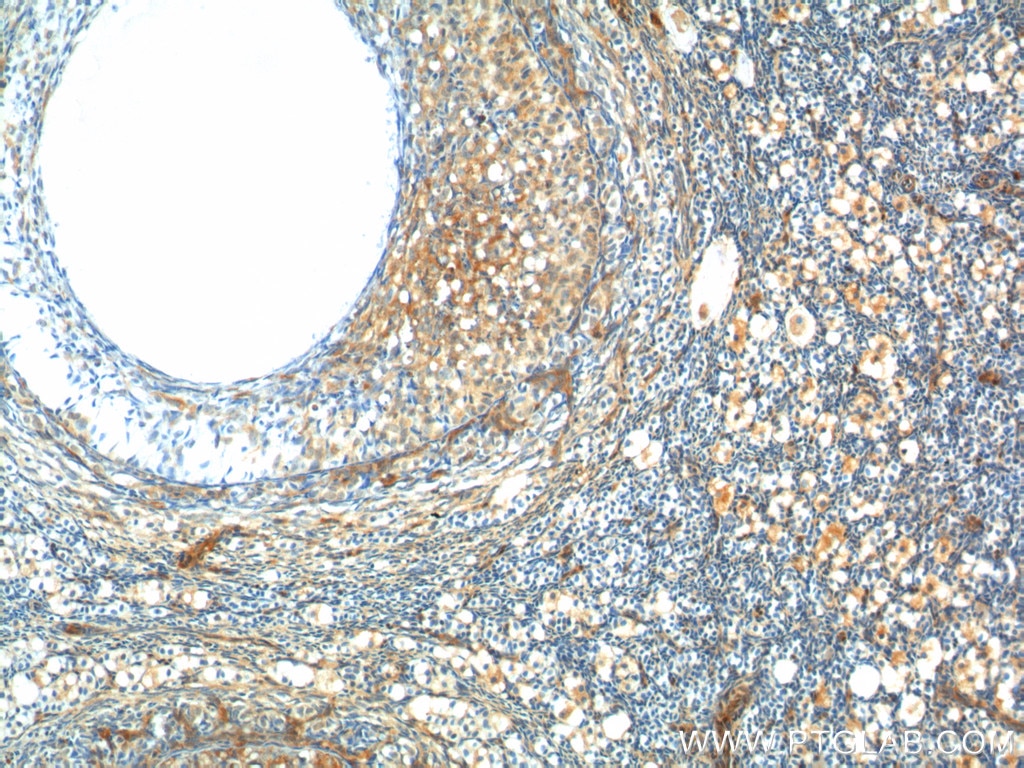 Immunohistochemistry (IHC) staining of human ovary tissue using GNRHR Polyclonal antibody (19950-1-AP)