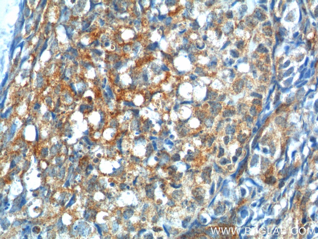 Immunohistochemistry (IHC) staining of human ovary tissue using GNRHR Polyclonal antibody (19950-1-AP)
