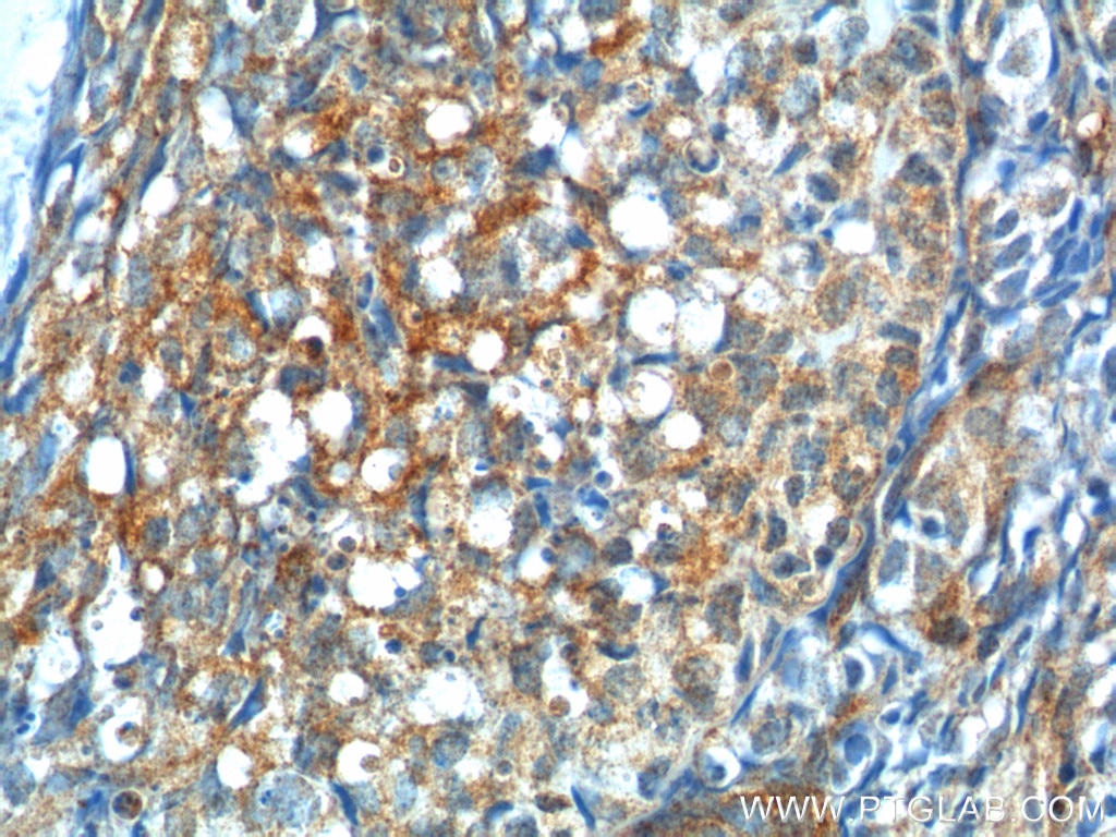 Immunohistochemistry (IHC) staining of human ovary tissue using GNRHR Polyclonal antibody (19950-1-AP)