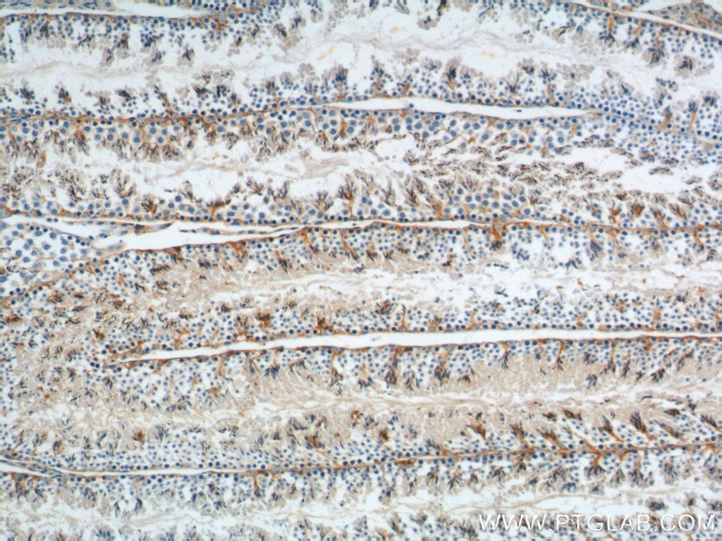 Immunohistochemistry (IHC) staining of mouse testis tissue using GNRHR Polyclonal antibody (19950-1-AP)