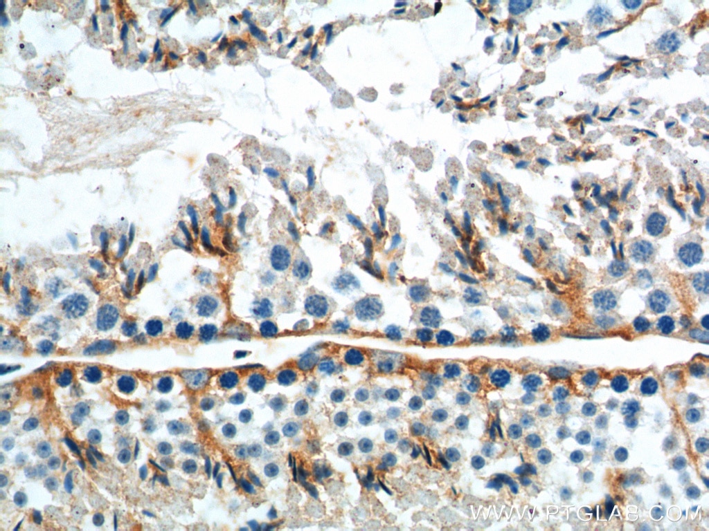 Immunohistochemistry (IHC) staining of mouse testis tissue using GNRHR Polyclonal antibody (19950-1-AP)