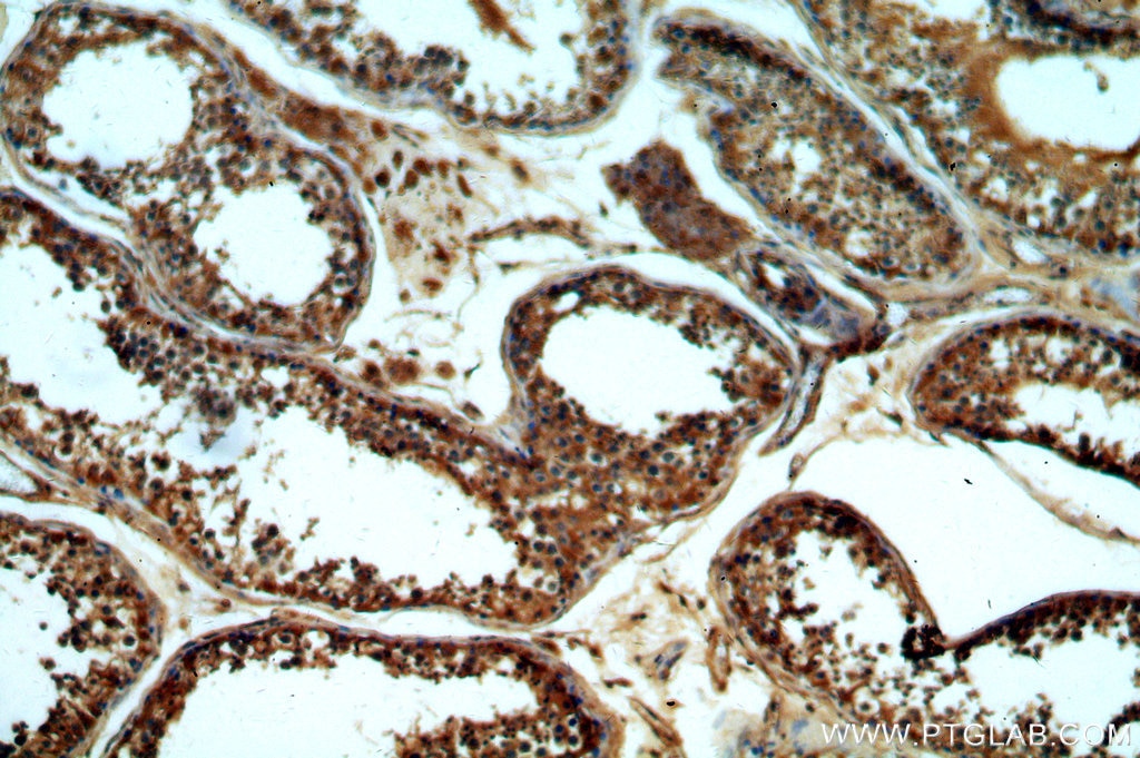 Immunohistochemistry (IHC) staining of human testis tissue using GNRHR Polyclonal antibody (19950-1-AP)