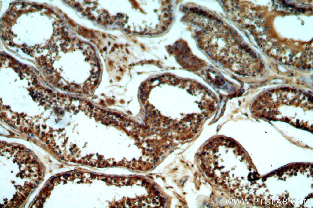 IHC staining of human testis using 19950-1-AP