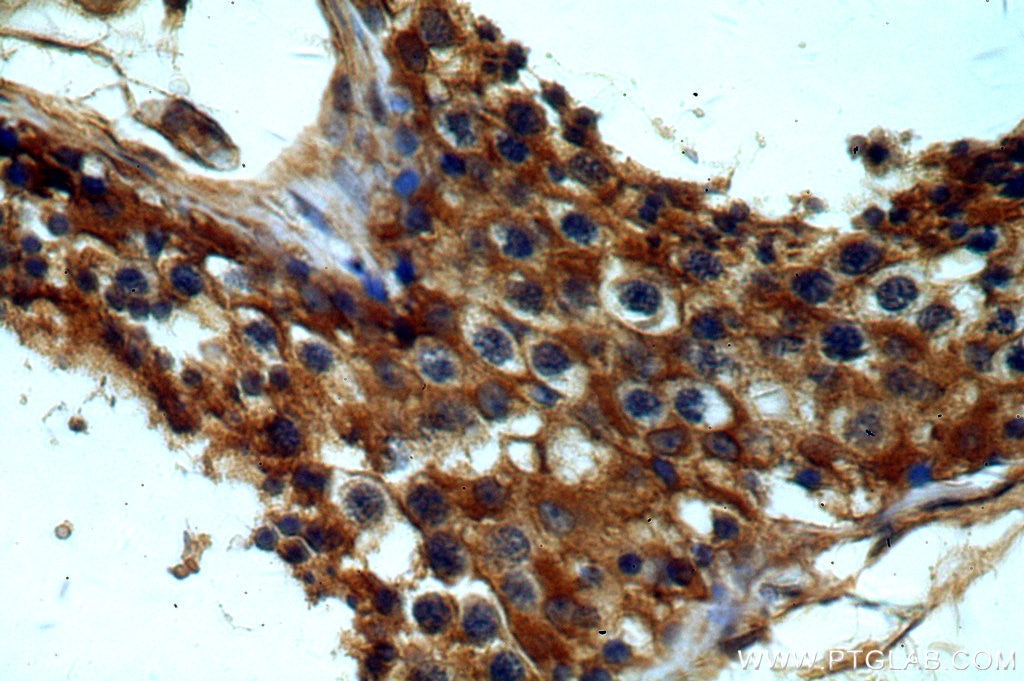 Immunohistochemistry (IHC) staining of human testis tissue using GNRHR Polyclonal antibody (19950-1-AP)