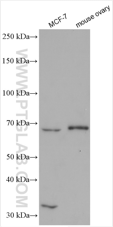 Western Blot (WB) analysis of various lysates using GNRHR Polyclonal antibody (19950-1-AP)