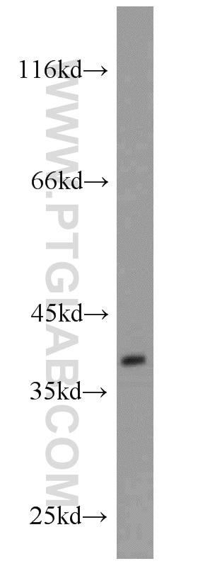 GNRHR Polyclonal antibody