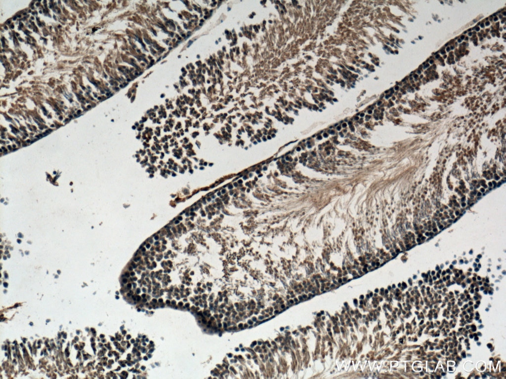 Immunohistochemistry (IHC) staining of rat testis tissue using GNRHR Polyclonal antibody (22462-1-AP)