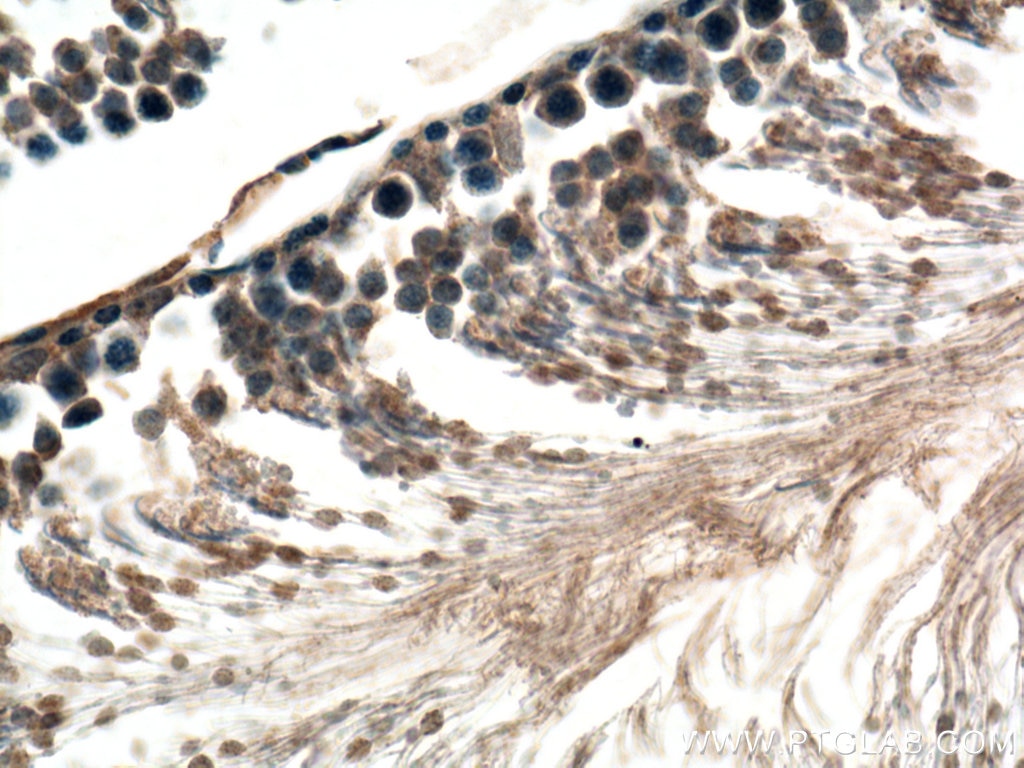 Immunohistochemistry (IHC) staining of rat testis tissue using GNRHR Polyclonal antibody (22462-1-AP)