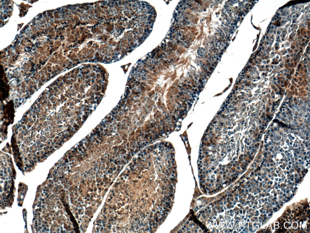 Immunohistochemistry (IHC) staining of mouse testis tissue using GNRHR Polyclonal antibody (22462-1-AP)